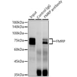 Western Blot - Anti-FMRP Antibody [ARC1026] (A307211) - Antibodies.com