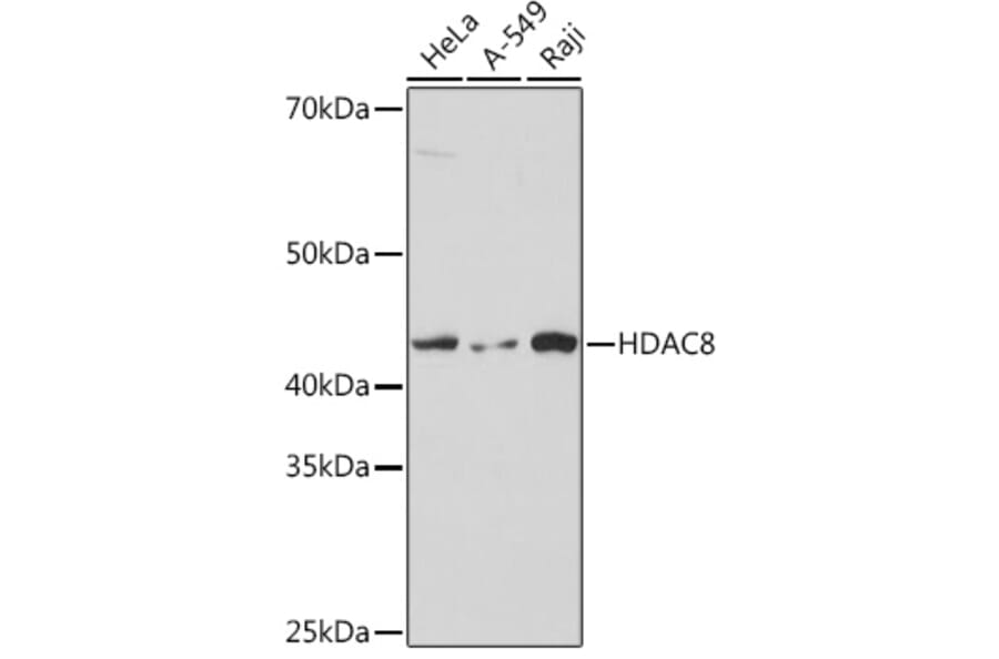 Western Blot - Anti-HDAC8 Antibody [ARC1331] (A307212) - Antibodies.com