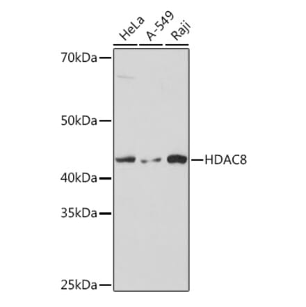 Western Blot - Anti-HDAC8 Antibody [ARC1331] (A307212) - Antibodies.com