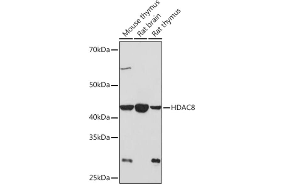 Western Blot - Anti-HDAC8 Antibody [ARC1331] (A307212) - Antibodies.com