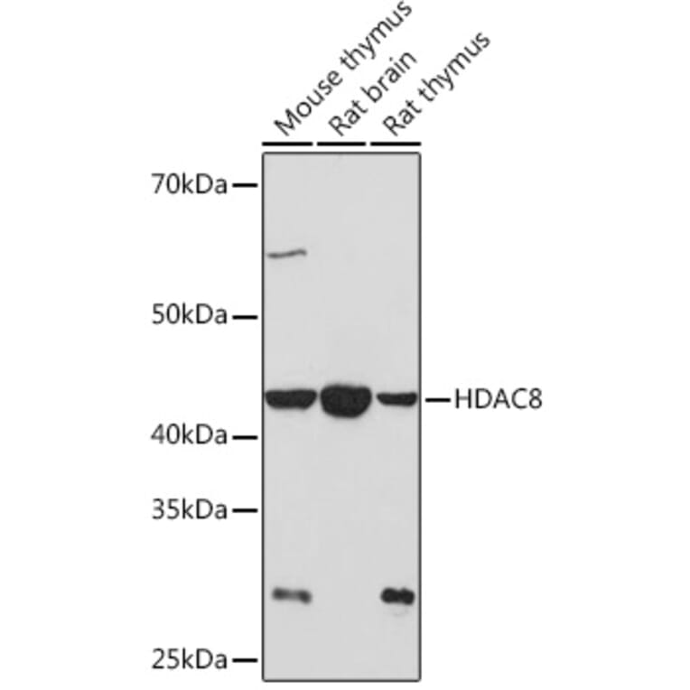 Western Blot - Anti-HDAC8 Antibody [ARC1331] (A307212) - Antibodies.com