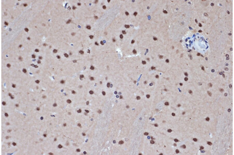 Immunohistochemistry - Anti-HDAC8 Antibody [ARC1331] (A307212) - Antibodies.com
