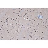 Immunohistochemistry - Anti-HDAC8 Antibody [ARC1331] (A307212) - Antibodies.com