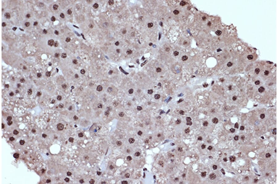 Immunohistochemistry - Anti-HDAC8 Antibody [ARC1331] (A307212) - Antibodies.com