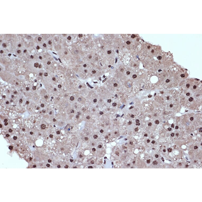 Immunohistochemistry - Anti-HDAC8 Antibody [ARC1331] (A307212) - Antibodies.com