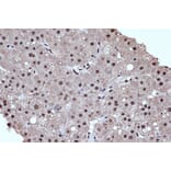 Immunohistochemistry - Anti-HDAC8 Antibody [ARC1331] (A307212) - Antibodies.com