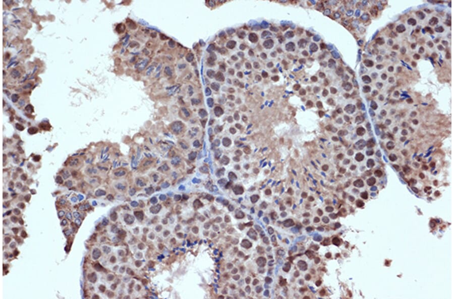 Immunohistochemistry - Anti-HDAC8 Antibody [ARC1331] (A307212) - Antibodies.com