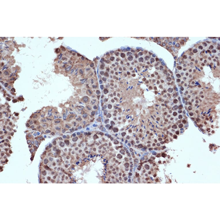 Immunohistochemistry - Anti-HDAC8 Antibody [ARC1331] (A307212) - Antibodies.com