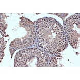 Immunohistochemistry - Anti-HDAC8 Antibody [ARC1331] (A307212) - Antibodies.com