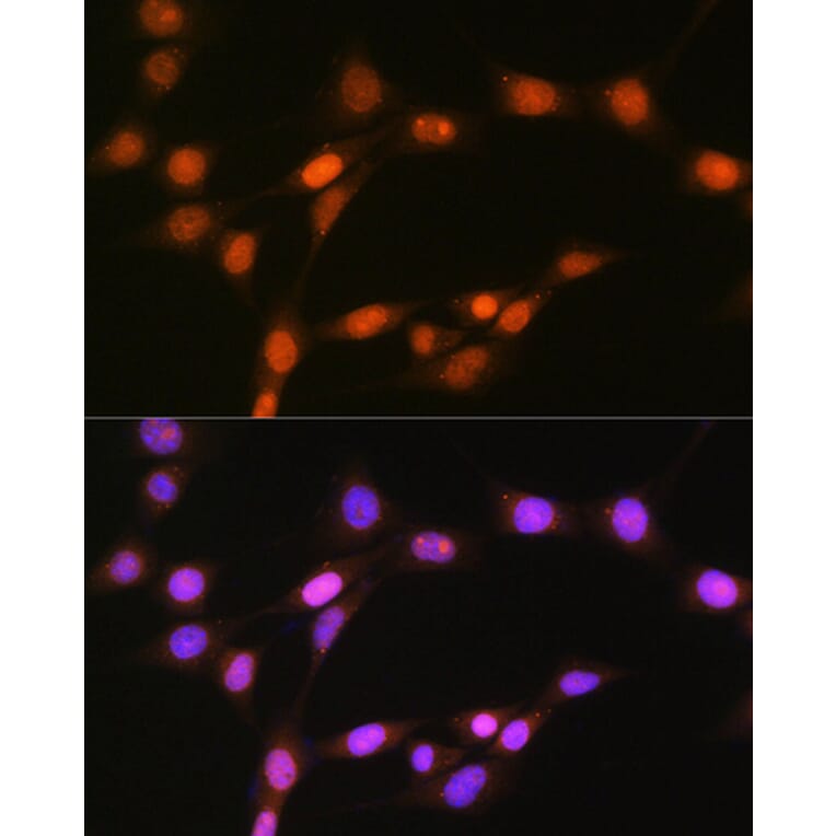 Immunofluorescence - Anti-HDAC8 Antibody [ARC1331] (A307212) - Antibodies.com