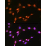 Immunofluorescence - Anti-HDAC8 Antibody [ARC1331] (A307212) - Antibodies.com