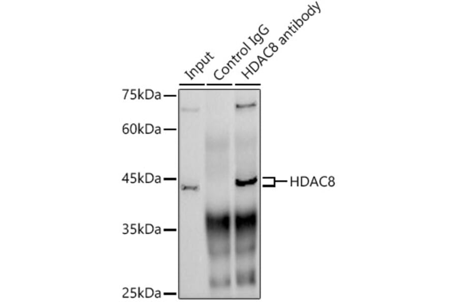 Western Blot - Anti-HDAC8 Antibody [ARC1331] (A307212) - Antibodies.com