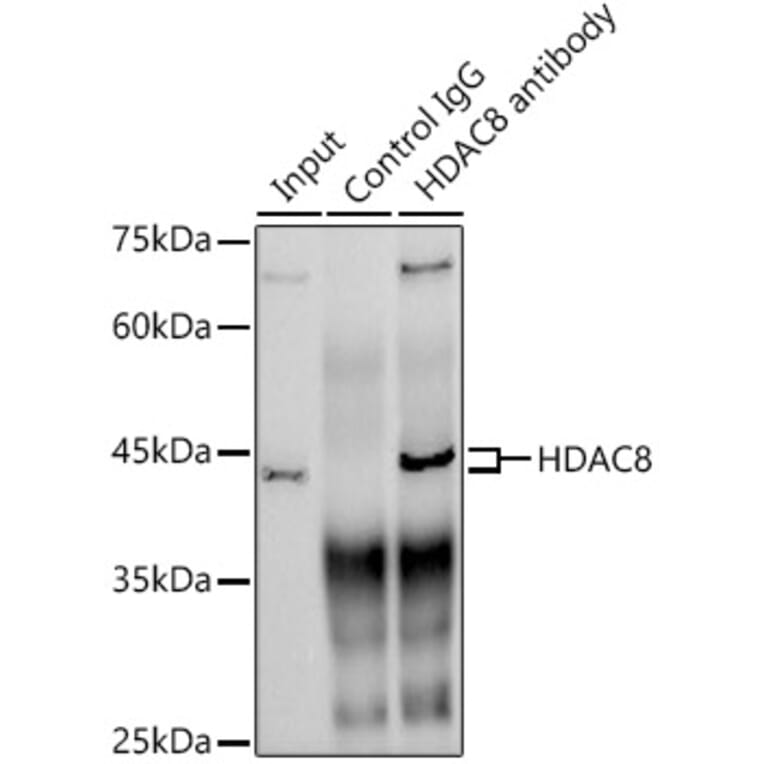 Western Blot - Anti-HDAC8 Antibody [ARC1331] (A307212) - Antibodies.com