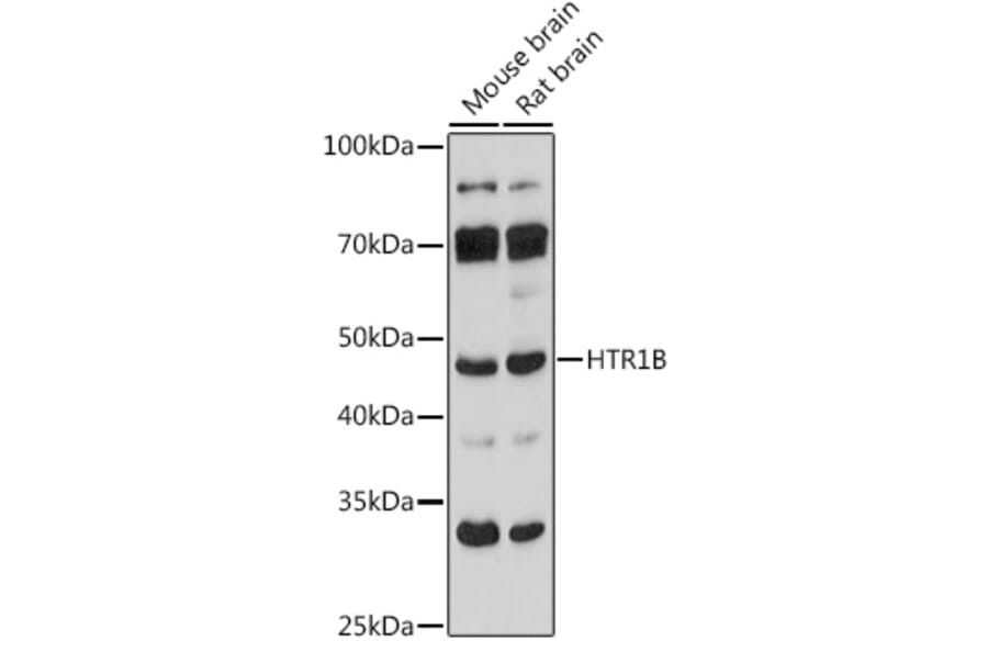 Western Blot - Anti-5HT1B Receptor Antibody (A307213) - Antibodies.com