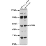 Western Blot - Anti-5HT1B Receptor Antibody (A307213) - Antibodies.com