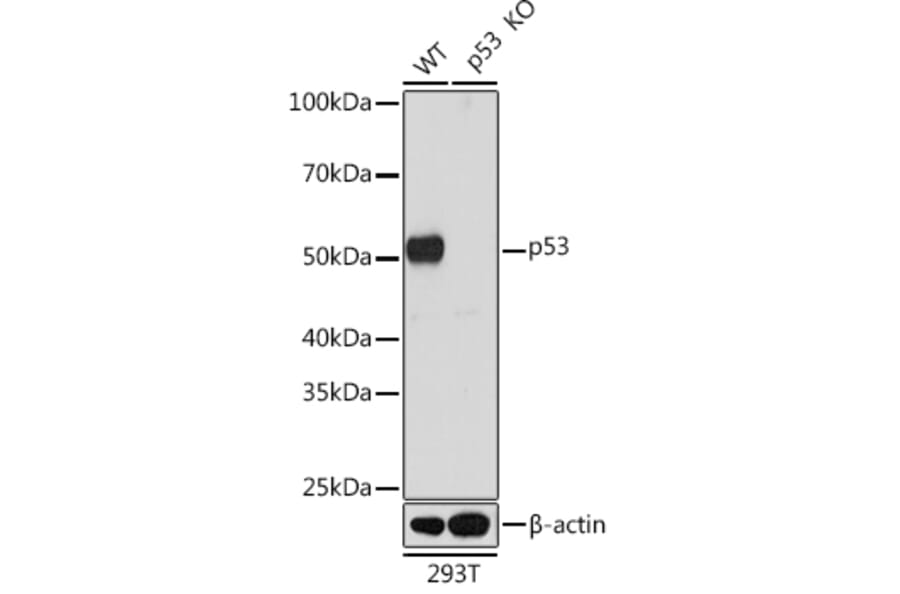 Western Blot - Anti-p53 Antibody (A307215) - Antibodies.com
