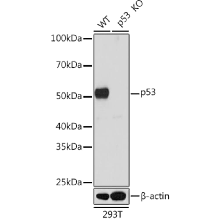 Western Blot - Anti-p53 Antibody (A307215) - Antibodies.com