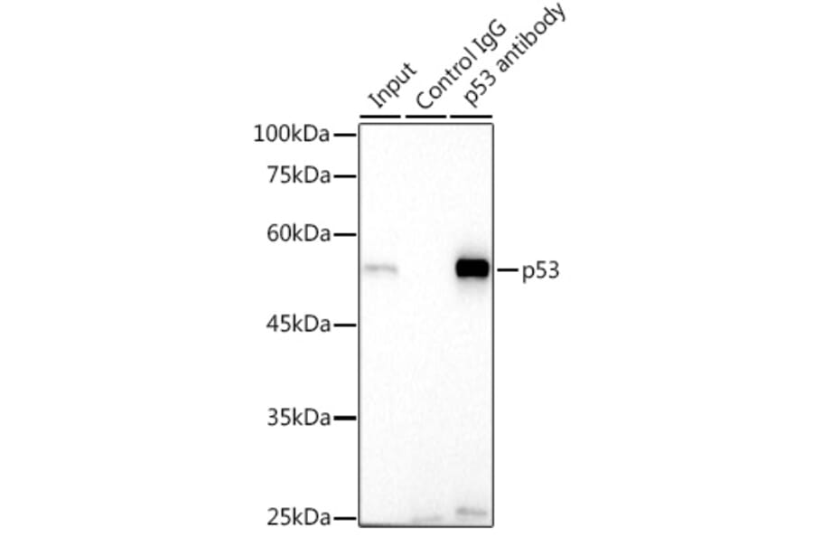 Western Blot - Anti-p53 Antibody (A307215) - Antibodies.com