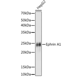 Western Blot - Anti-Ephrin A1 Antibody [ARC1443] (A307223) - Antibodies.com
