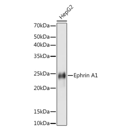Western Blot - Anti-Ephrin A1 Antibody [ARC1443] (A307223) - Antibodies.com