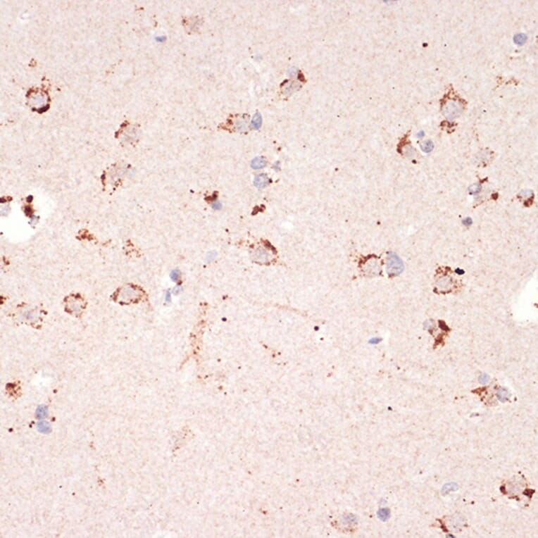 Immunohistochemistry - Anti-Ephrin A1 Antibody [ARC1443] (A307223) - Antibodies.com