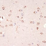 Immunohistochemistry - Anti-Ephrin A1 Antibody [ARC1443] (A307223) - Antibodies.com