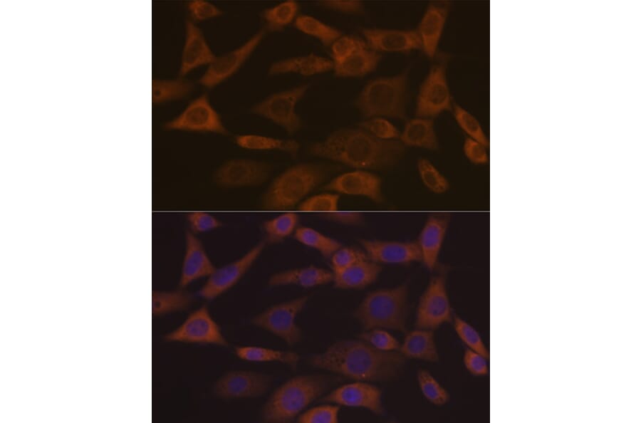 Immunofluorescence - Anti-Ephrin A1 Antibody [ARC1443] (A307223) - Antibodies.com
