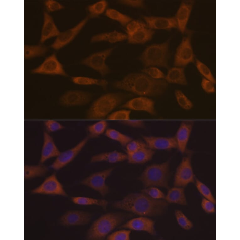 Immunofluorescence - Anti-Ephrin A1 Antibody [ARC1443] (A307223) - Antibodies.com