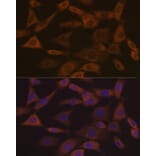 Immunofluorescence - Anti-Ephrin A1 Antibody [ARC1443] (A307223) - Antibodies.com