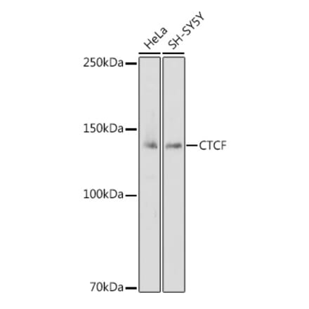Western Blot - Anti-CTCF Antibody (A307225) - Antibodies.com
