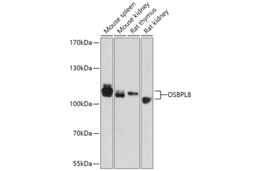 Western Blot - Anti-ORP8 Antibody (A307228) - Antibodies.com