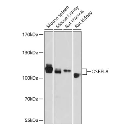 Western Blot - Anti-ORP8 Antibody (A307228) - Antibodies.com