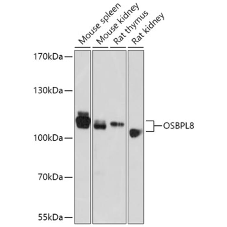 Western Blot - Anti-ORP8 Antibody (A307228) - Antibodies.com