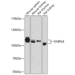 Western Blot - Anti-ORP8 Antibody (A307228) - Antibodies.com
