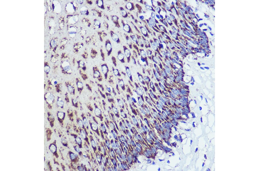 Immunohistochemistry - Anti-ORP8 Antibody (A307228) - Antibodies.com