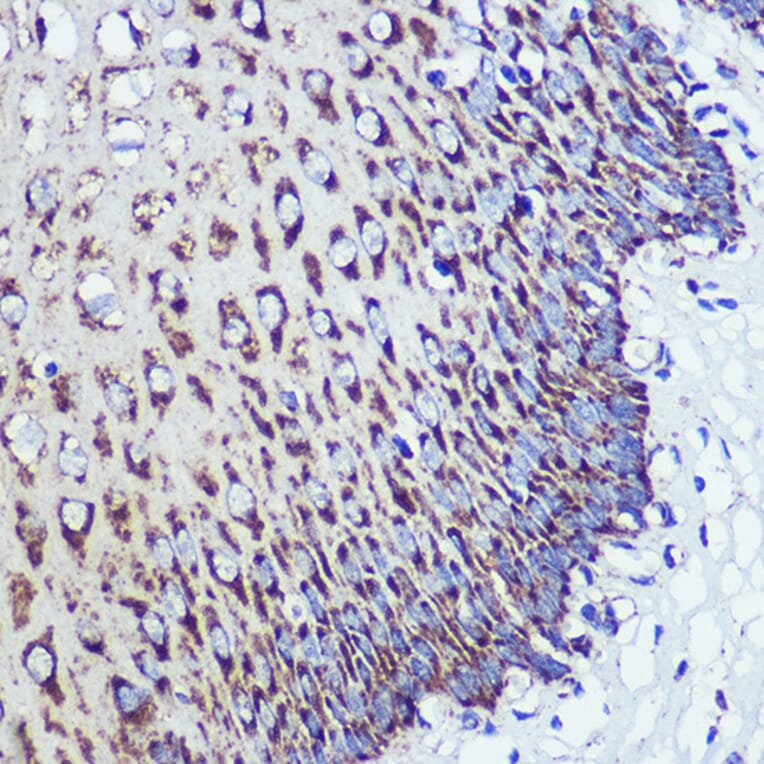 Immunohistochemistry - Anti-ORP8 Antibody (A307228) - Antibodies.com