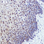 Immunohistochemistry - Anti-ORP8 Antibody (A307228) - Antibodies.com