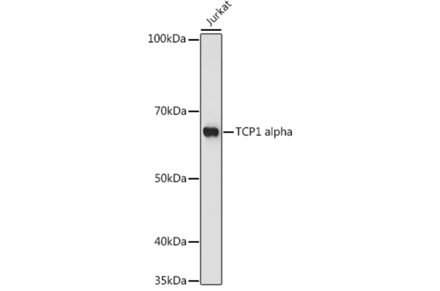 Western Blot - Anti-TCP1 alpha/CCTA Antibody (A307231) - Antibodies.com