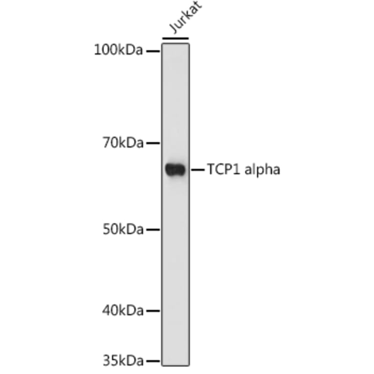 Western Blot - Anti-TCP1 alpha/CCTA Antibody (A307231) - Antibodies.com