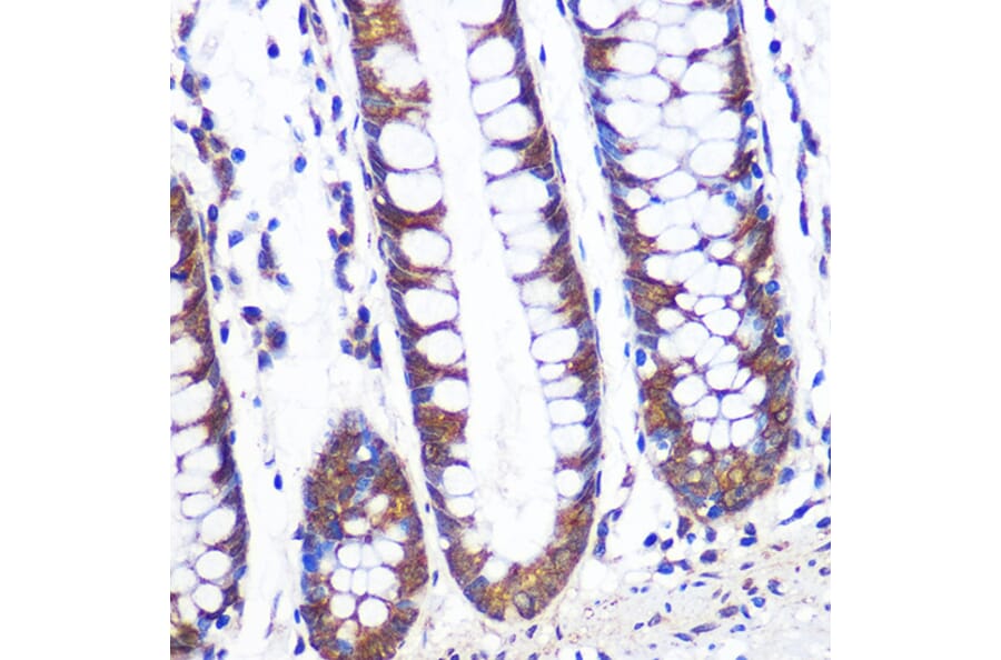 Immunohistochemistry - Anti-TCP1 alpha/CCTA Antibody (A307231) - Antibodies.com