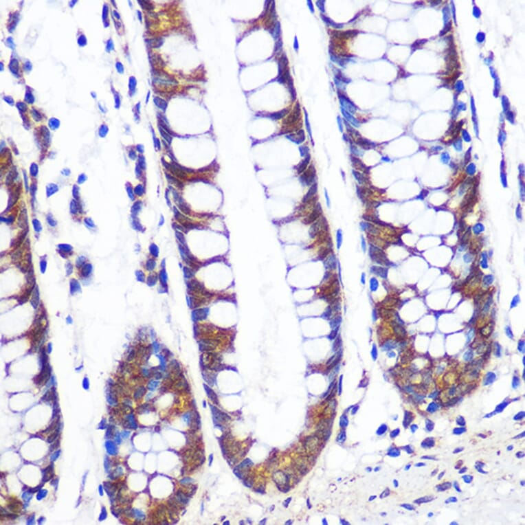 Immunohistochemistry - Anti-TCP1 alpha/CCTA Antibody (A307231) - Antibodies.com