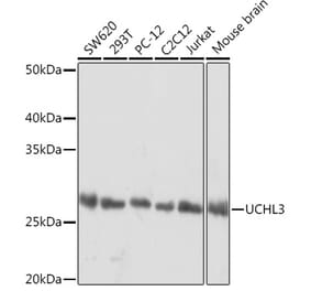 Western Blot - Anti-UCHL3 Antibody [ARC1874] (A307232) - Antibodies.com