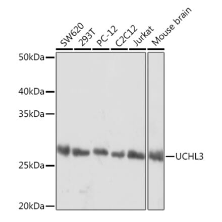 Western Blot - Anti-UCHL3 Antibody [ARC1874] (A307232) - Antibodies.com