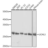 Western Blot - Anti-UCHL3 Antibody [ARC1874] (A307232) - Antibodies.com