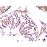 Immunohistochemistry - Anti-UCHL3 Antibody [ARC1874] (A307232) - Antibodies.com