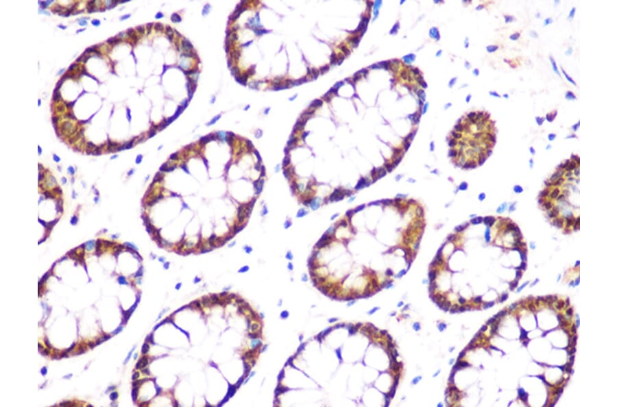 Immunohistochemistry - Anti-UCHL3 Antibody [ARC1874] (A307232) - Antibodies.com