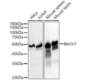 Western Blot - Anti-Beclin 1 Antibody [ARC52858] (A307233) - Antibodies.com