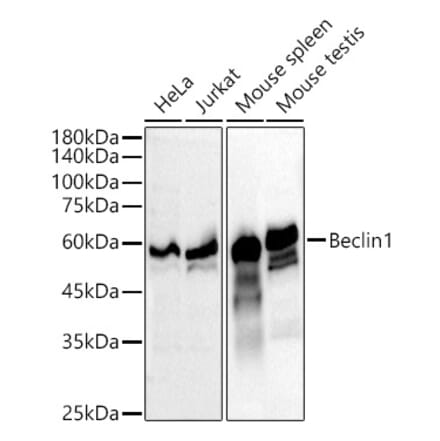 Western Blot - Anti-Beclin 1 Antibody [ARC52858] (A307233) - Antibodies.com