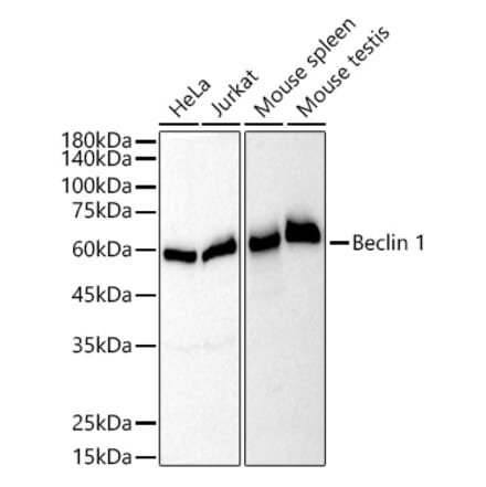 Western Blot - Anti-Beclin 1 Antibody [ARC52856] (A307234) - Antibodies.com
