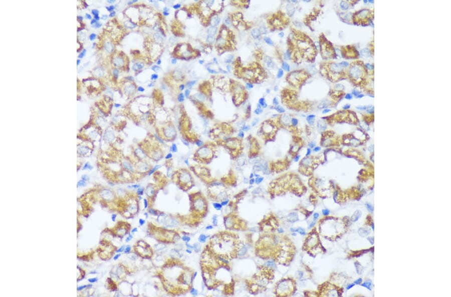 Immunohistochemistry - Anti-Beclin 1 Antibody (A307235) - Antibodies.com